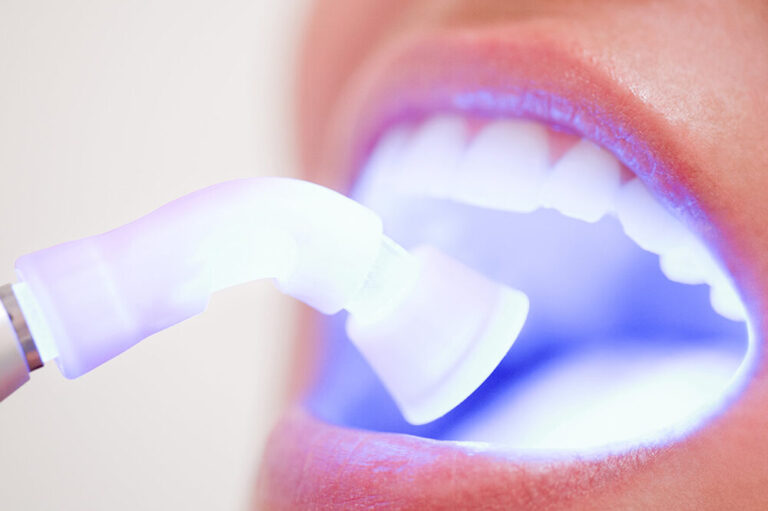 A dentist uses a soft tissue laser to treat patient