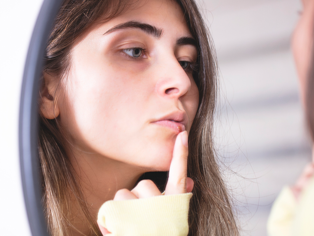 woman looking close in the mirror at a cold sore