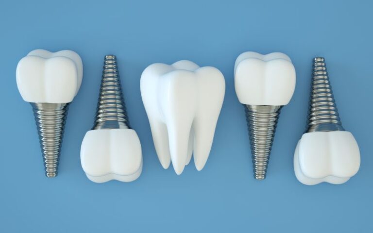 dental implants lined in a row